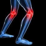 Home Health Care in Elizabeth NJ: Senior Joint Pain