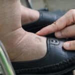 Elderly Care in Elizabeth NJ: Inflammation