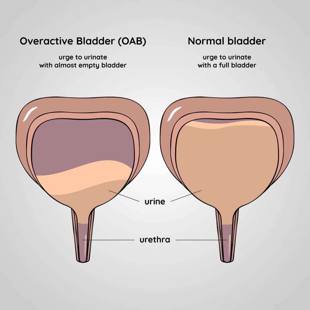 Elder Care in Elizabeth NJ: Bladder Care